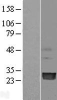 PMVK Human Over-expression Lysate