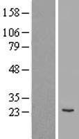 COPS8 Human Over-expression Lysate