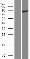 CENPI Human Over-expression Lysate