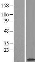 APM2 (ADIRF) Human Over-expression Lysate