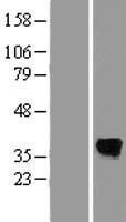 SDS Human Over-expression Lysate