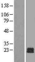RAC1 Human Over-expression Lysate