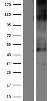 SLC19A2 Human Over-expression Lysate