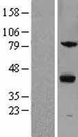 ZPBP1 (ZPBP) Human Over-expression Lysate