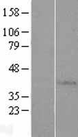 AP4S1 Human Over-expression Lysate