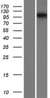 SARDH Human Over-expression Lysate