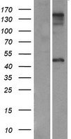 ZP3 Human Over-expression Lysate