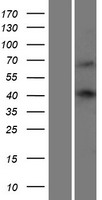WW domain binding protein 4 (WBP4) Human Over-expression Lysate