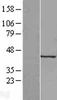 Keratocan (KERA) Human Over-expression Lysate