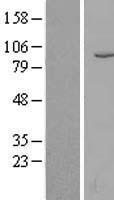 CD10 (MME) Human Over-expression Lysate