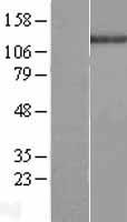 c Abl (ABL1) Human Over-expression Lysate