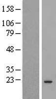 COMMD3 Human Over-expression Lysate