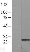 HDHD1A (PUDP) Human Over-expression Lysate