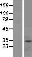 FBXO2 Human Over-expression Lysate