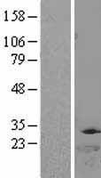 DTYMK Human Over-expression Lysate