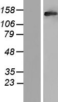 RAB3GAP2 Human Over-expression Lysate
