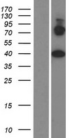 PRICKLE4 Human Over-expression Lysate