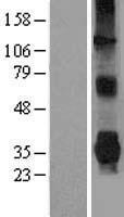 Parkin (PARK2) Human Over-expression Lysate
