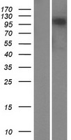 MRTFB Human Over-expression Lysate