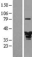 EB2 (MAPRE2) Human Over-expression Lysate