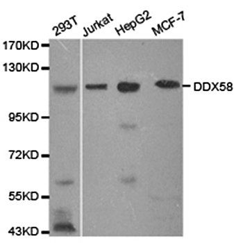 DDX58 antibody