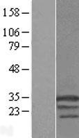 Hsp22 (HSPB8) Human Over-expression Lysate