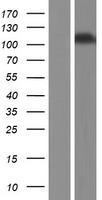 Inversin (INVS) Human Over-expression Lysate