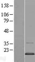 TMEM97 Human Over-expression Lysate