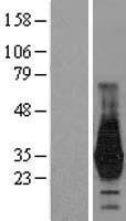 HOXD4 Human Over-expression Lysate
