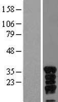 Vgl4 (VGLL4) Human Over-expression Lysate