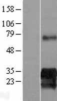 KIAA0247 (SUSD6) Human Over-expression Lysate