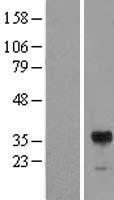 RIMS3 Human Over-expression Lysate