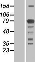 KIAA0323 (KHNYN) Human Over-expression Lysate