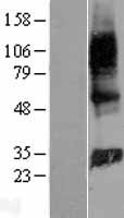 GIMAP2 Human Over-expression Lysate