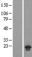 PPPDE2 (DESI1) Human Over-expression Lysate