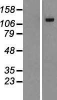 DENND2A Human Over-expression Lysate