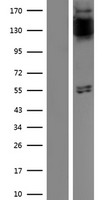 FGFR1 Human Over-expression Lysate