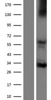 NOX3 Human Over-expression Lysate