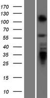 Pokemon (ZBTB7A) Human Over-expression Lysate