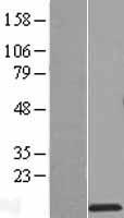 RPS27L Human Over-expression Lysate