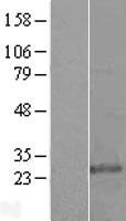 Glutathione S Transferase kappa 1 (GSTK1) Human Over-expression Lysate