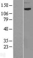 NBAS Human Over-expression Lysate