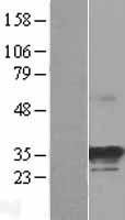 NOSIP Human Over-expression Lysate