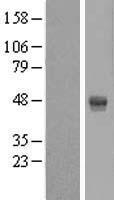 AMDHD2 Human Over-expression Lysate