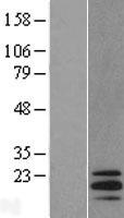 STMN3 Human Over-expression Lysate
