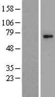 CHST15 Human Over-expression Lysate