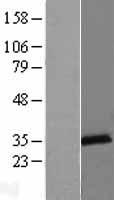 LACTB2 Human Over-expression Lysate