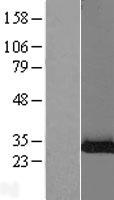 Shwachman Bodian Diamond syndrome (SBDS) Human Over-expression Lysate