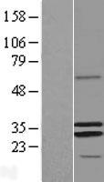 MRPS2 Human Over-expression Lysate