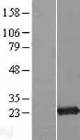 EXOSC1 Human Over-expression Lysate